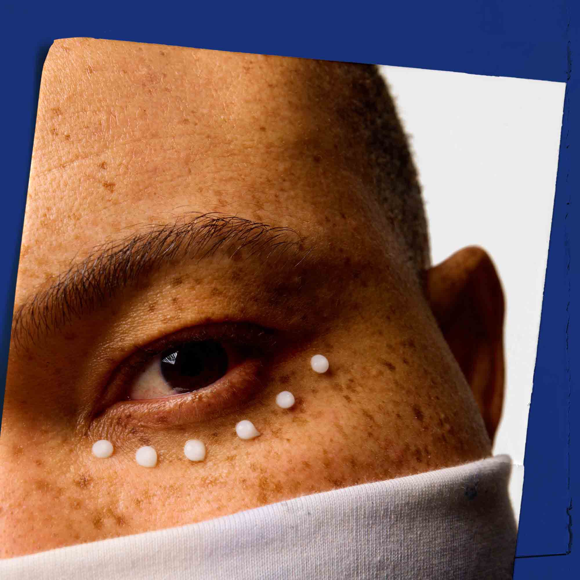 Gros plan sur la peau du contour des yeux parsemee de points de Facial Fuel Eye Fuel.