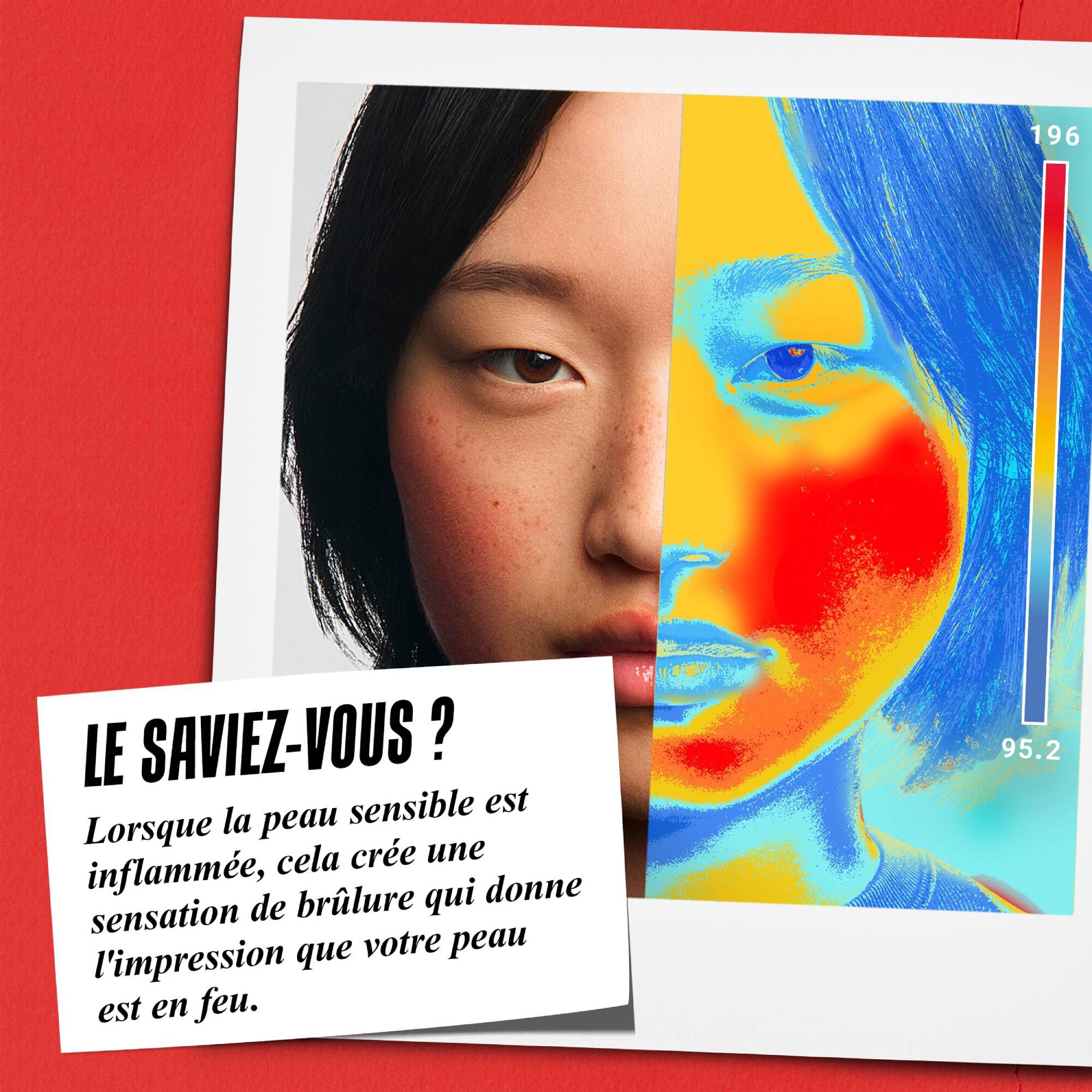 Le saviez-vous ? Lorsque la peau sensible est enflammee, cela cree une sensation de brulure qui donne l'impression que votre peau est en feu.