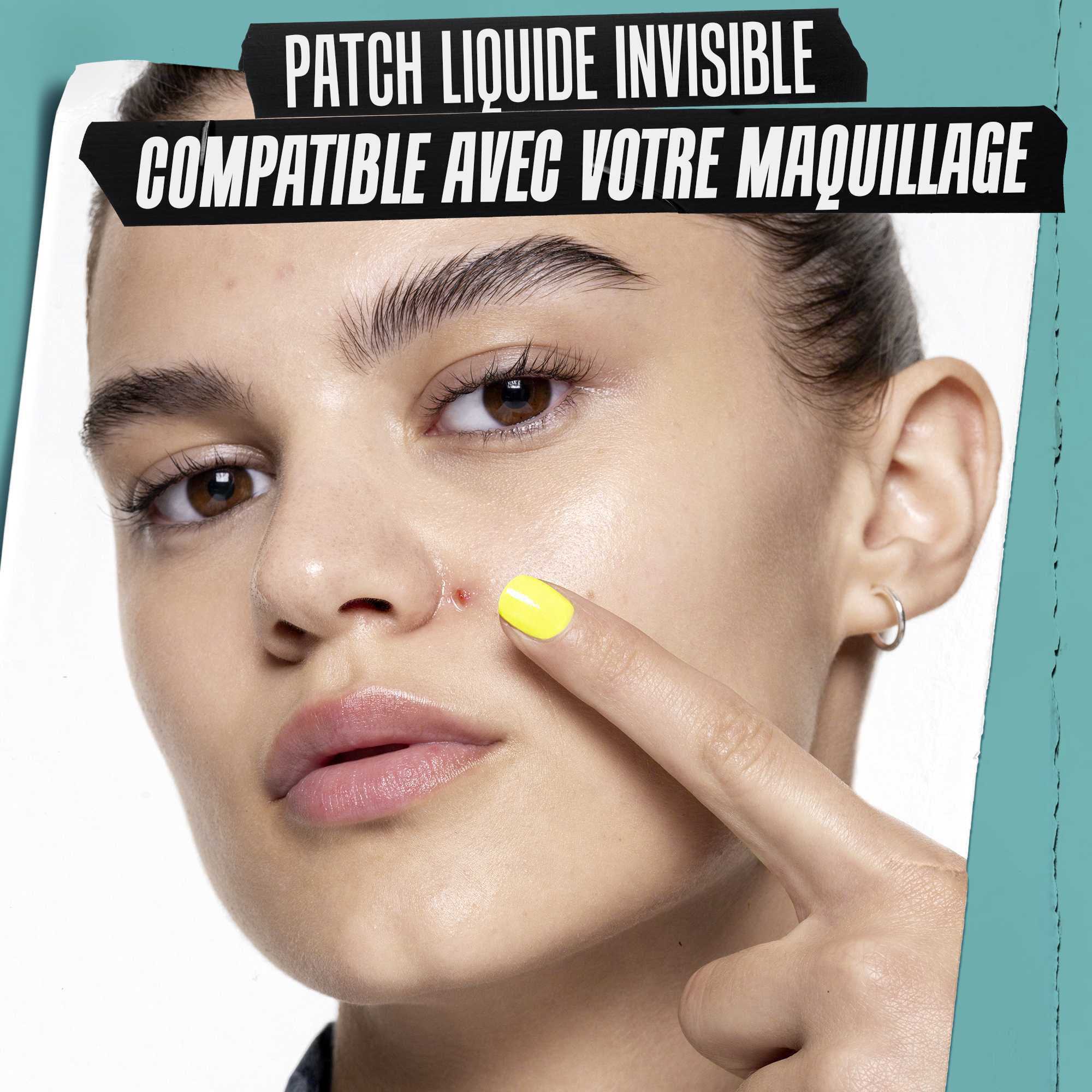 Application de la solution Truly-Targeted Blemish-Clearing Solution sur la peau.