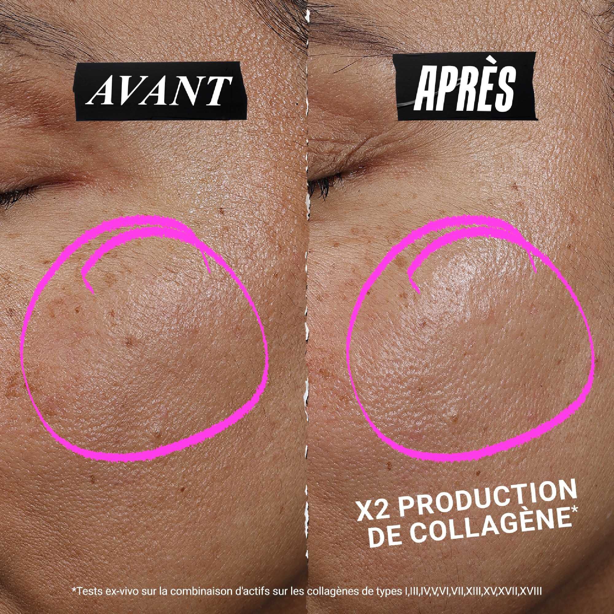 1cc CollaShot Plump Serum