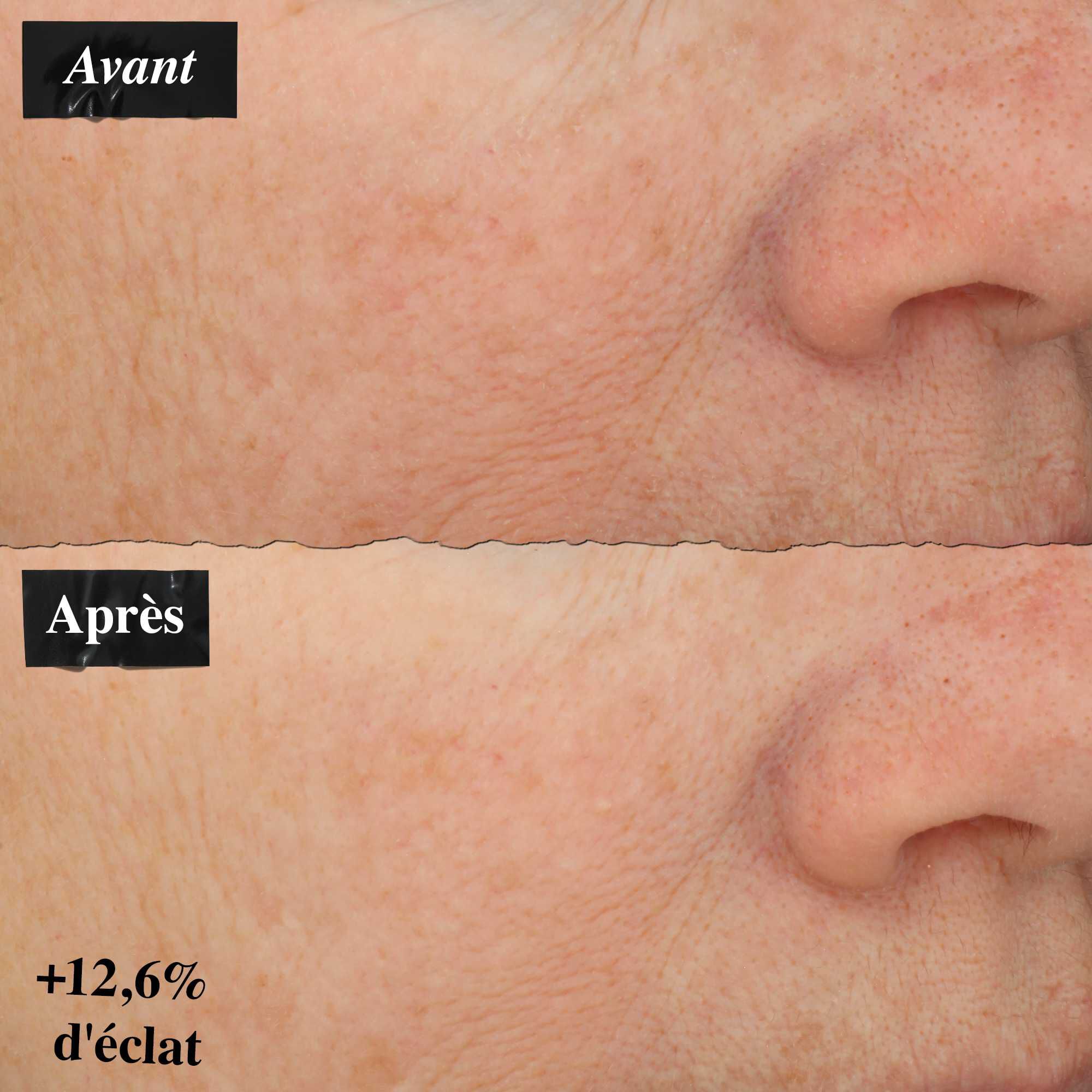 Une comparaison avant/apres montrant une amelioration des rougeurs de la peau apres utilisation du Powerful-Strength Line-Reducing Concentrate.