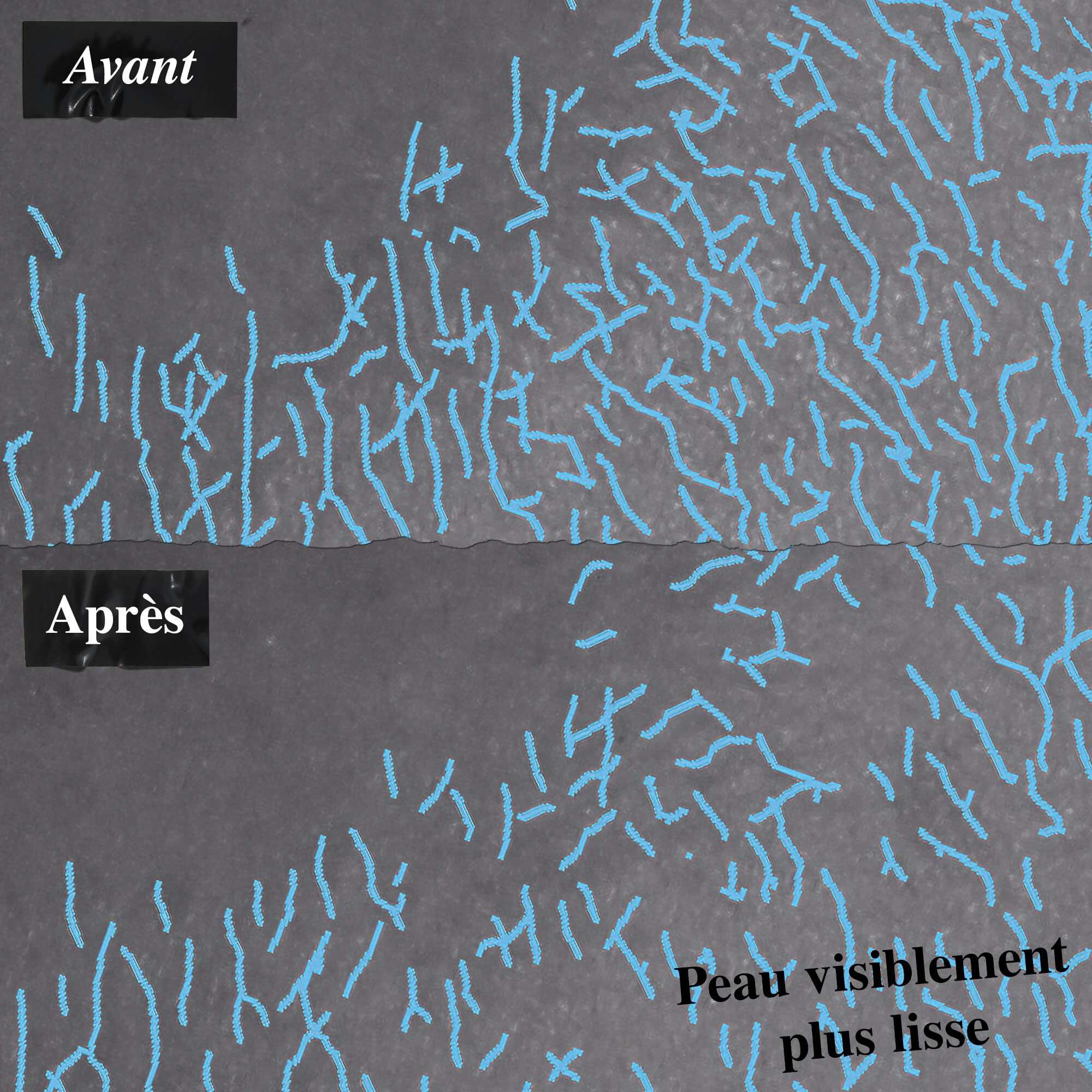 Une comparaison avant/apres de la texture de la peau montrant une peau visiblement plus lisse apres utilisation.