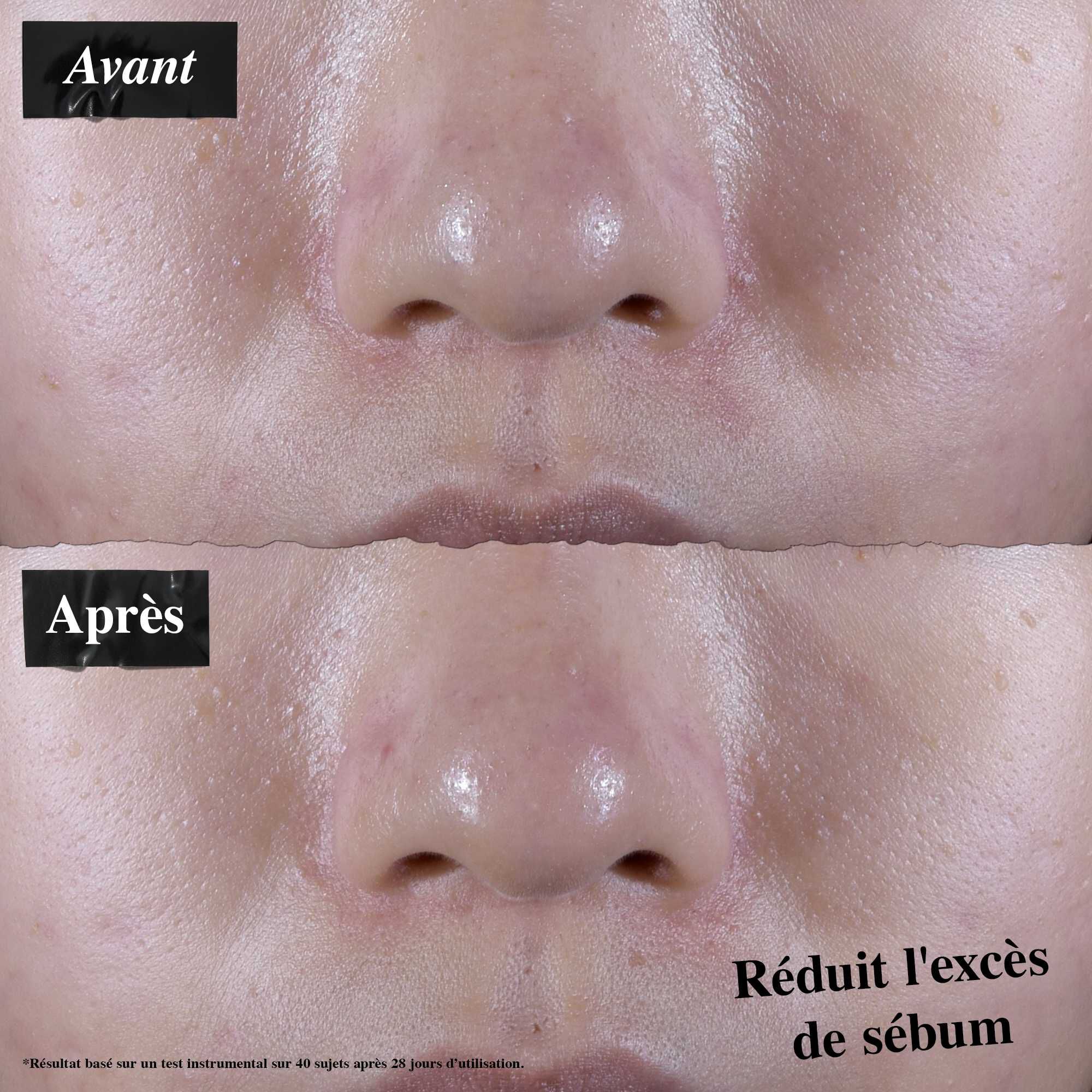 Comparaison avant/apres montrant une reduction de l'exces de sebum apres utilisation du gel-creme Ultra Facial Oil-Free Gel Cream.