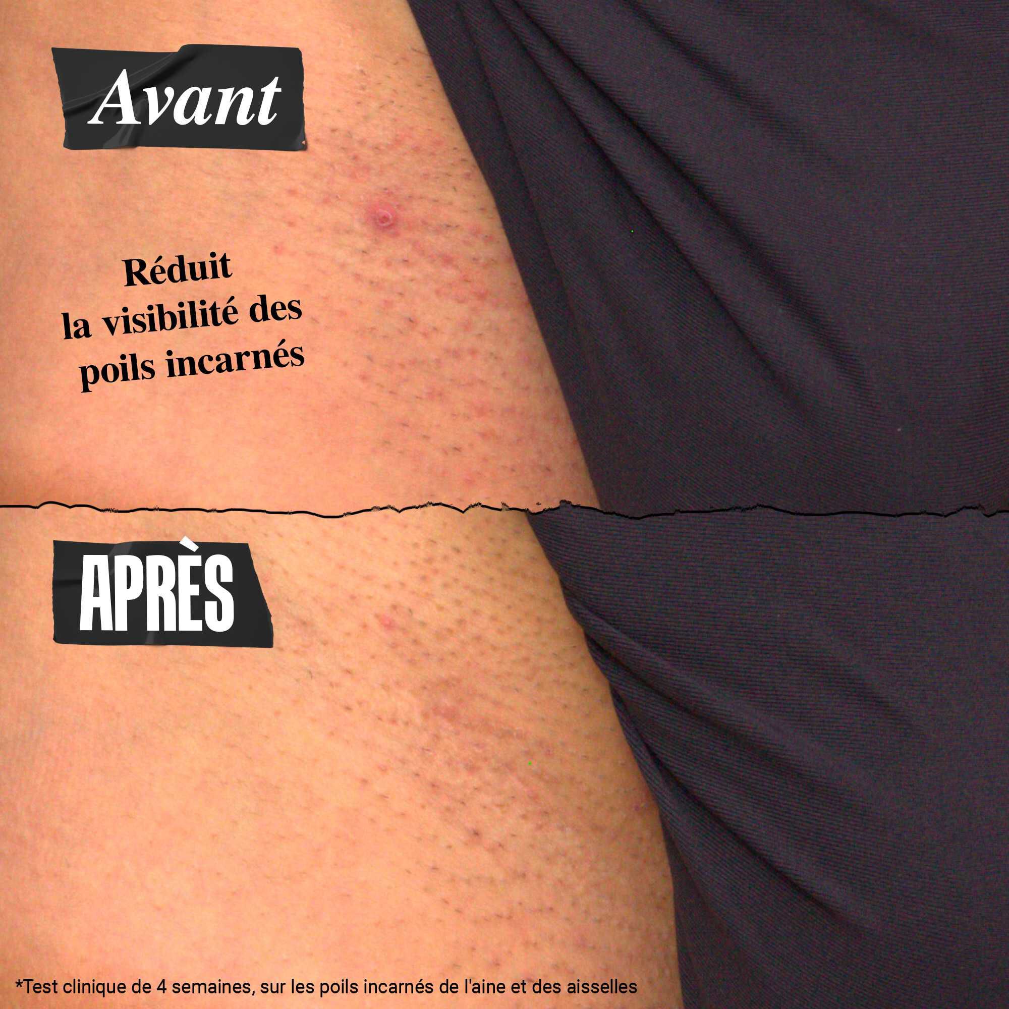 Ingrown Hair and Tone-Correcting Intimate Drops ingredients – AHA Blend, Astaxanthin, Jojoba Oil