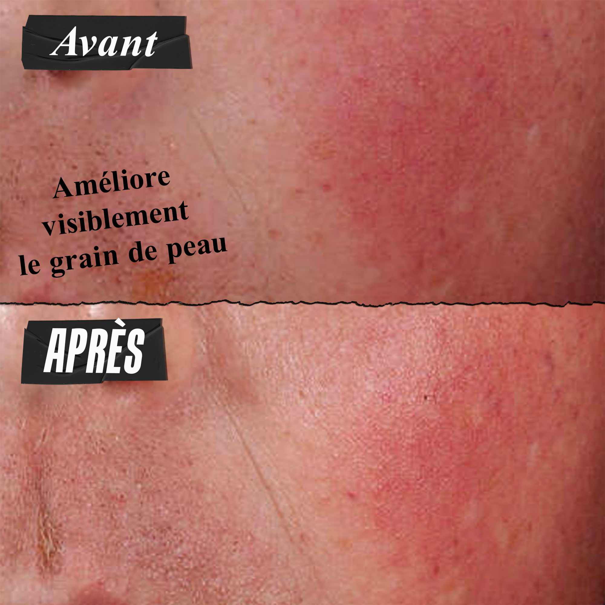 Photo Avant/Apres - La creme barriere Ultra Facial Kiehl's ameliore visiblement le teint