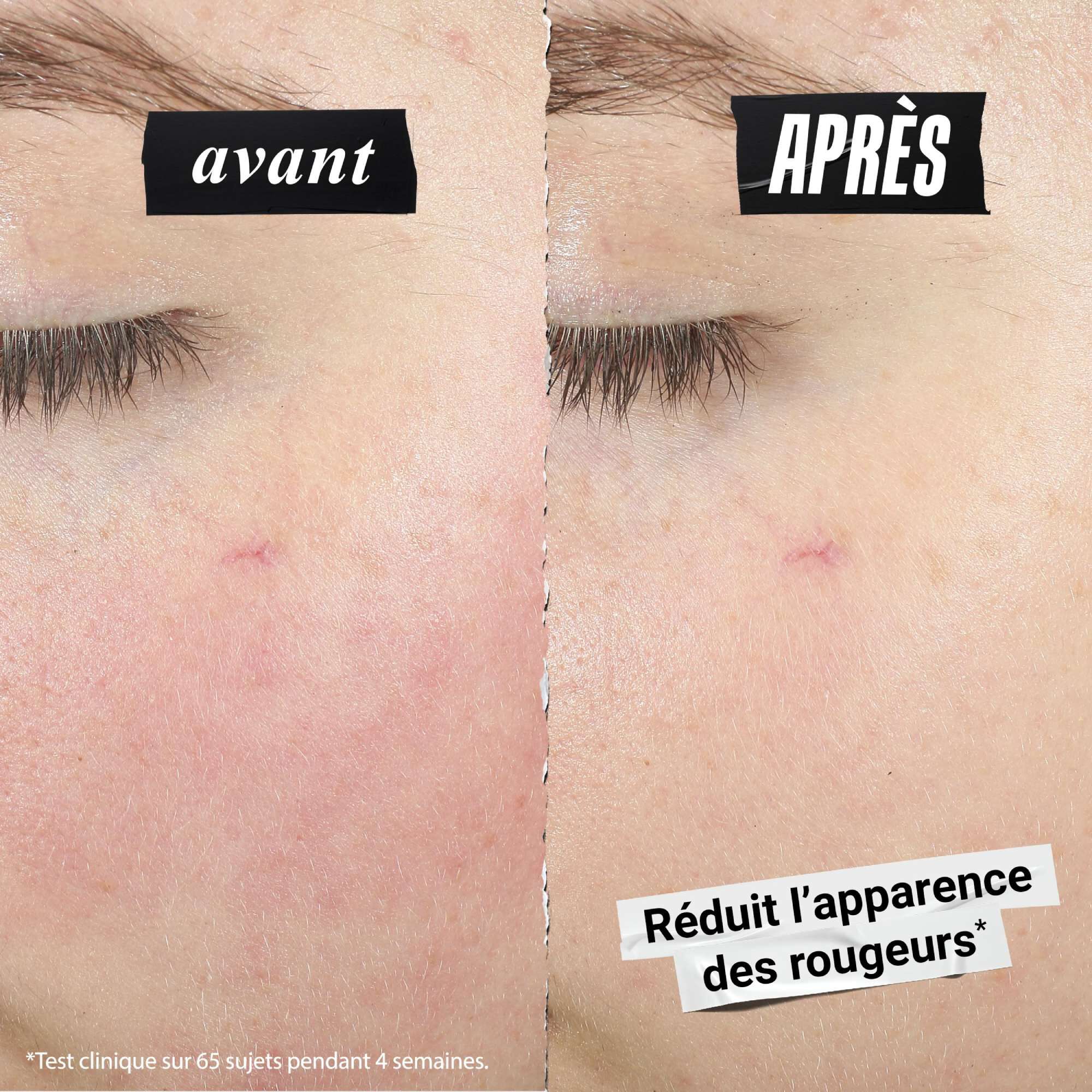 Comparaison montrant une reduction des rougeurs sur la peau. Le texte indique : Reduit visiblement les rougeurs.