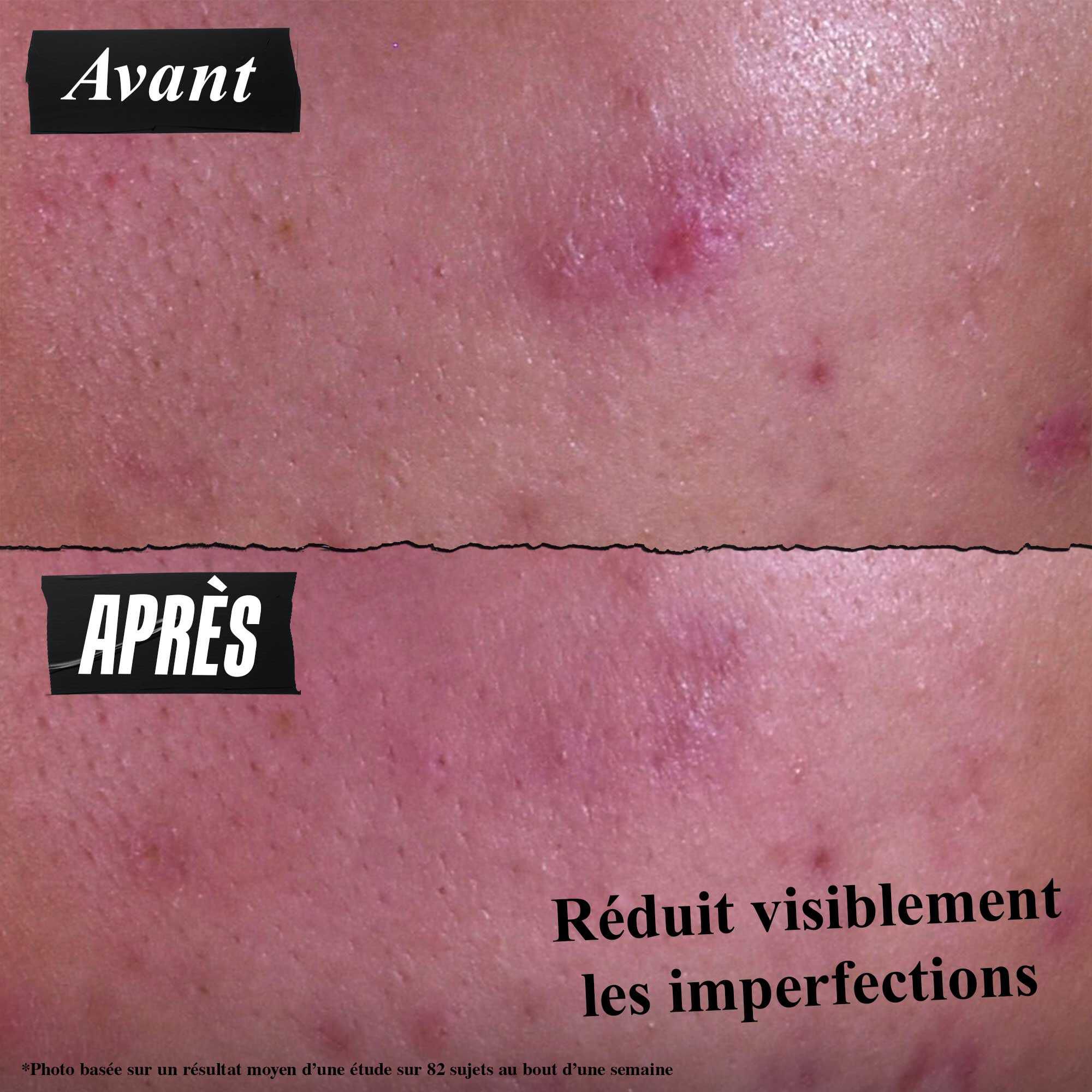 Pate anti-imperfections 3-en-1