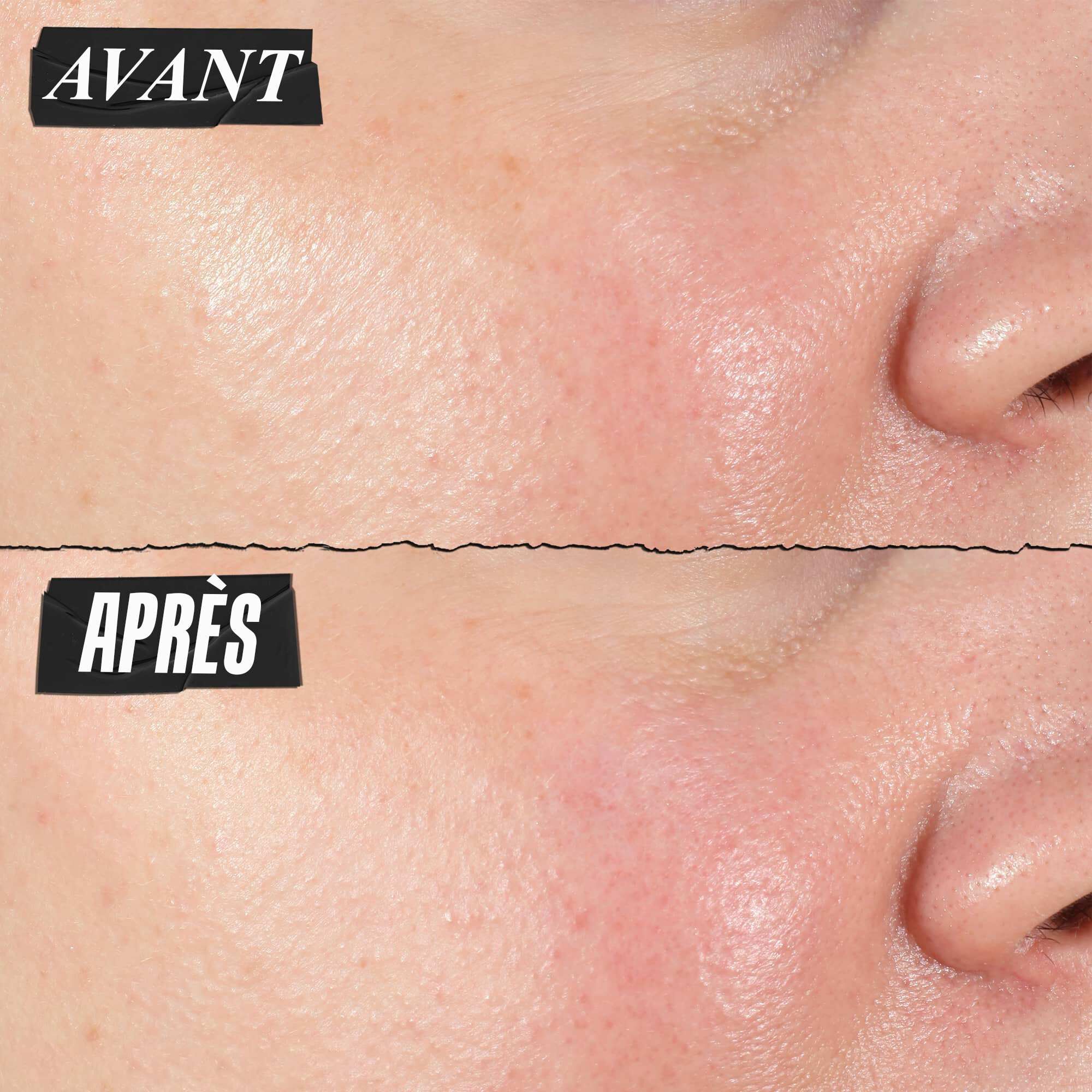 Photo Avant/Apres - Le Concentre de Serum Hydro-Repulpant Kiehl's reduit visiblement les pores