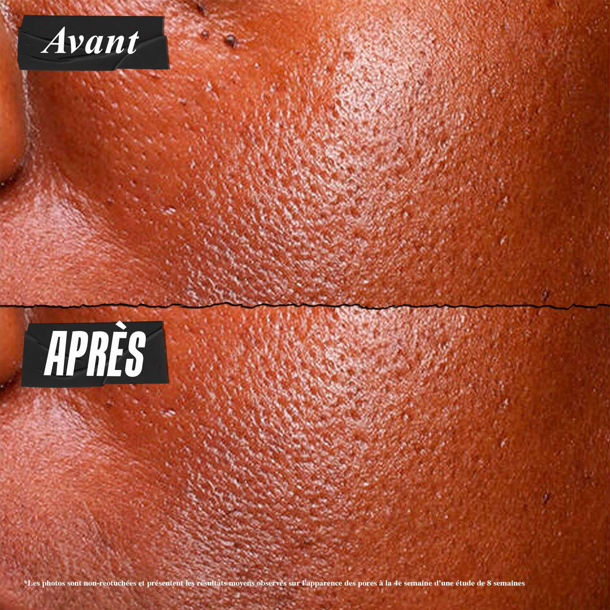 Photo Avant/Apres du Serum Ultra Pure Kiehl's reduisant visiblement l'exces de sebum