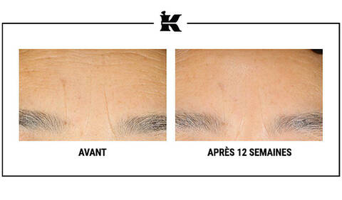 Teste Cliniquement