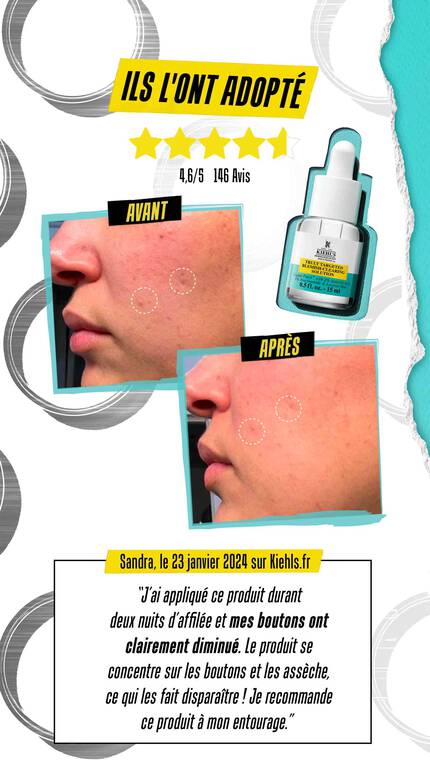 Avant et apres l'utilisation d'un produit de soin de la peau, montrant une amelioration significative des boutons, accompagne d'un temoignage d'une cliente satisfaite.