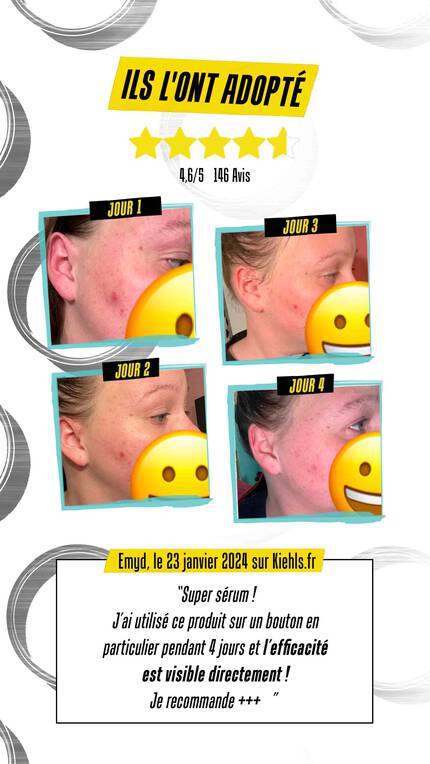 Avis de nos consommateurs: j'ai applique ce produit pendant 4 jours et l'efficacite est visible directement!