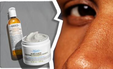 Visage avec 2 produits Kiehl's pour traiter les points noirs: Calendula Toner e Rare Earth Deep Pore Cleansing Mask