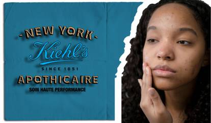 Une personne avec des imperfections sur le dos. Le masque Kiehl's Rare Earth, presente avec sa texture cremeuse, pour aider a purifier la peau et minimiser les pores.