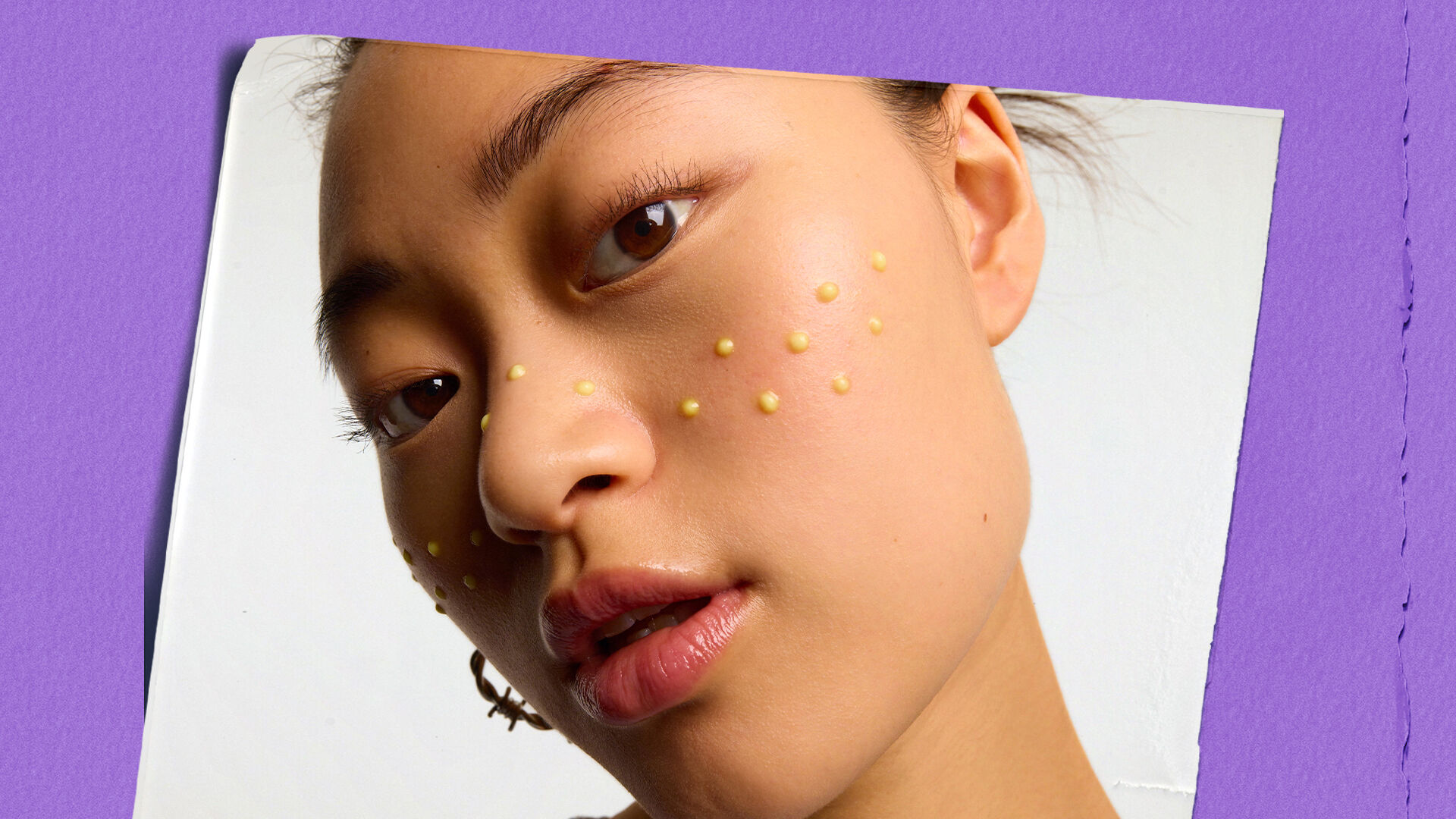 Visage d'une femme avec des points jaunes de traitement cutane sur fond violet.