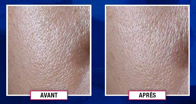 Ultra Facial Oil-Free Gel Cream