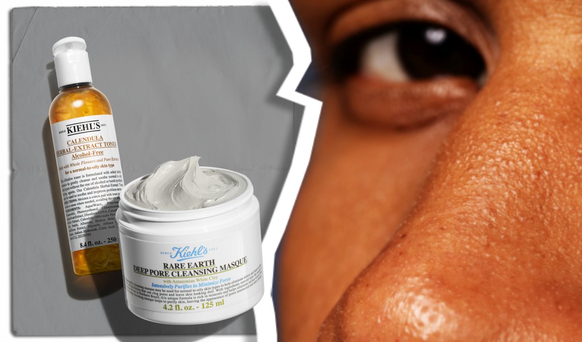 Visage avec 2 produits Kiehl's pour traiter les points noirs: Calendula Toner e Rare Earth Deep Pore Cleansing Mask