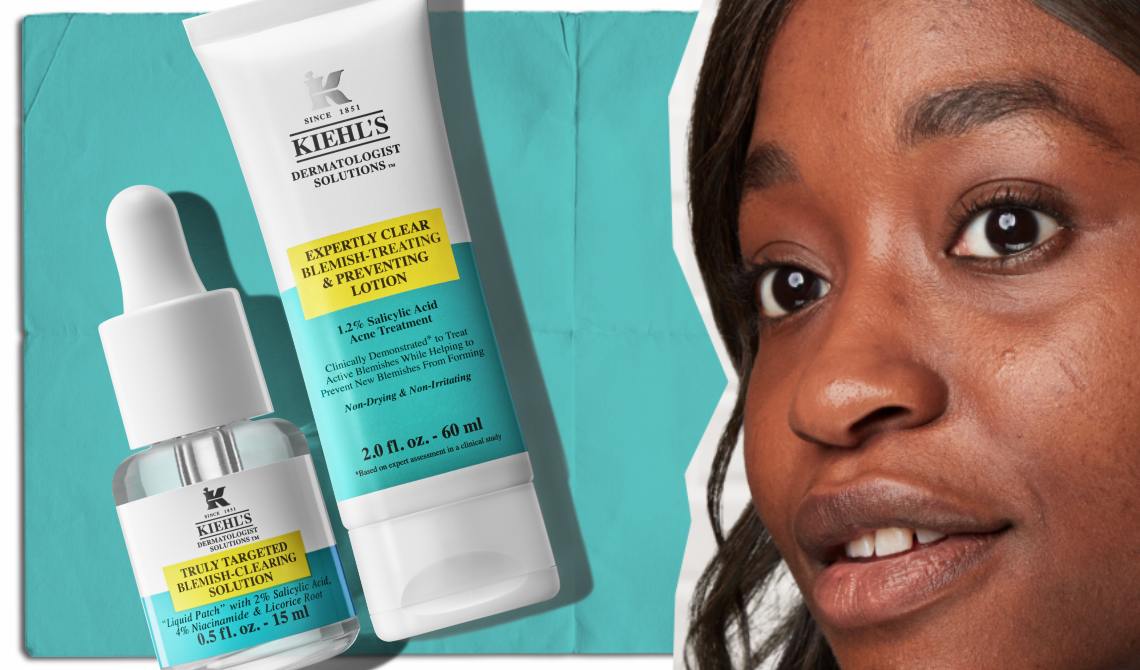 Femme avec des marques d'acne et 2 produits Kiehl's pour les traiter:  Truly Targeted Blemish-Clearing Solution et Expertly Clear Blemish-Treating & Preventing Lotion